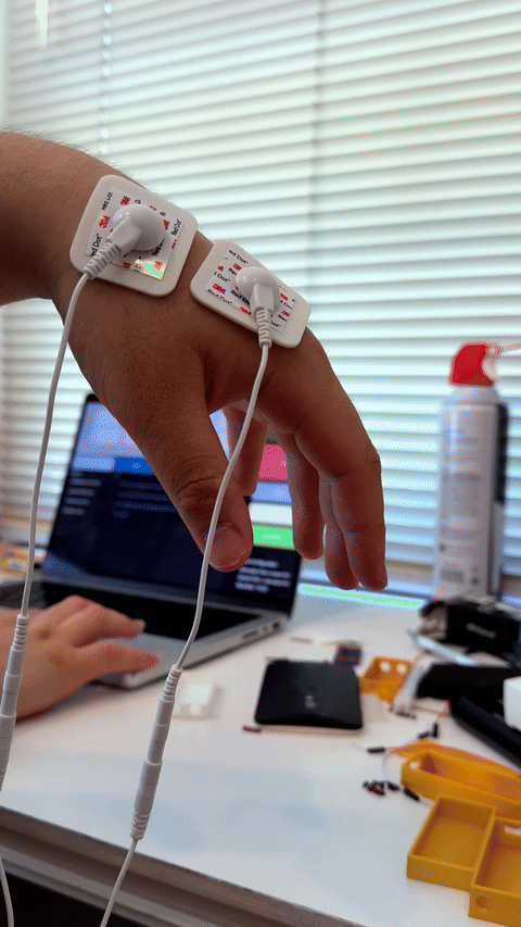 electrostimulation